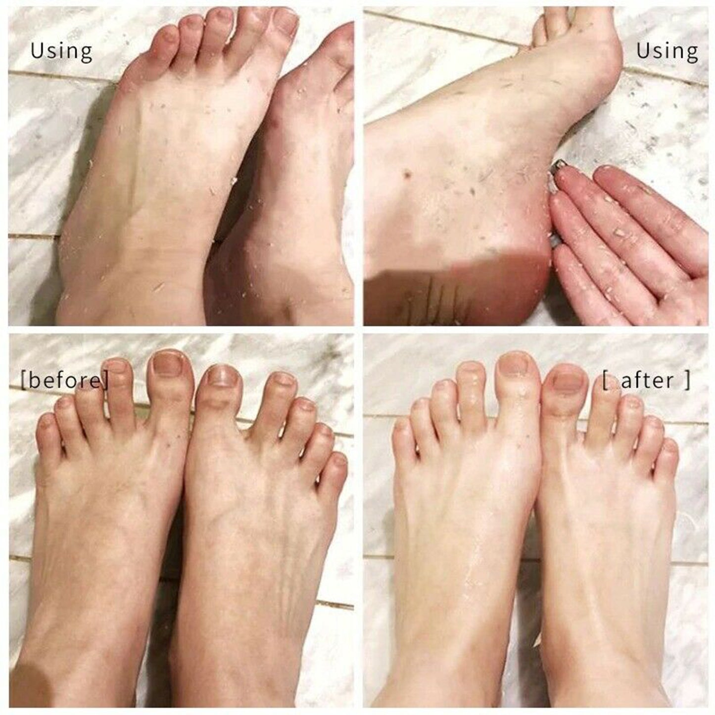 100ML Foot Peeling Spray Nourish Moisturizing Elbow Exfoliating Essence Dead Skin Remover Pedicure Foot Care Tool